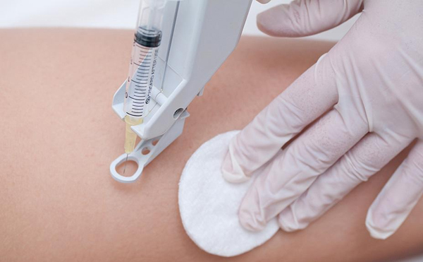 массаж на осокорках